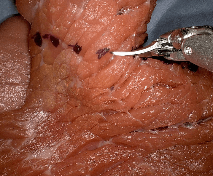 Dissection Automation thumbnail